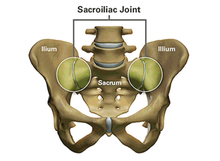 The sacroiliac joints. Where are they and why they might be the cause of your back pain!